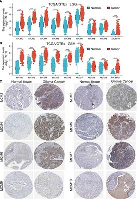 MCM4 is a novel prognostic biomarker and promotes cancer cell growth in glioma